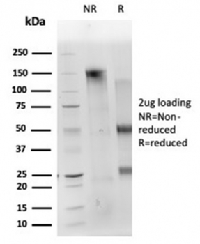 CD40L Antibody / TRAP / CD154