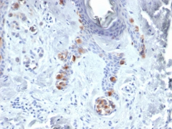 Tyrosinase Antibody / TYR