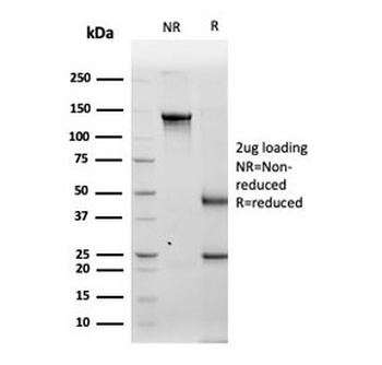 Tyrosinase Antibody / TYR