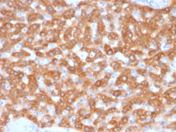SDHB Antibody