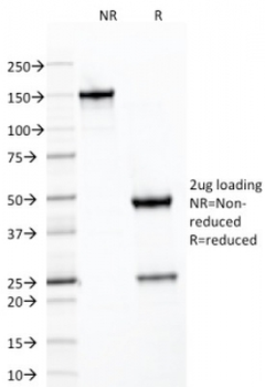 SDHB Antibody