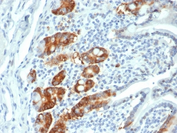 Ribonucleotide Reductase M1 Antibody / RRM1
