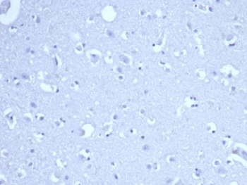 Ribonucleotide Reductase M1 Antibody / RRM1