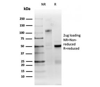 Ribonucleotide Reductase M1 Antibody / RRM1