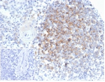 Interferon alpha 1 Antibody / IFNA1