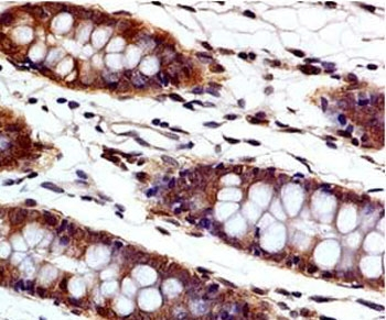 Caspase-3 Antibody, Pro and Active