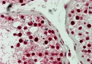 LSD1 Antibody / Lysine-Specific Demethylase 1