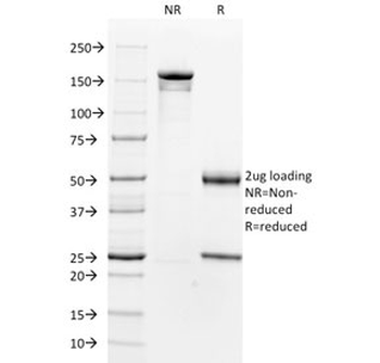 Alpha Actin Antibody / ACTA2 (smooth muscle)