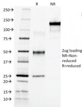 Alpha Fetoprotein / AFP Antibody