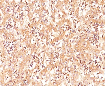 AFP Antibody / Alpha Fetoprotein