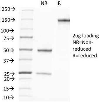 PSA Antibody / Prostate Specific Antigen