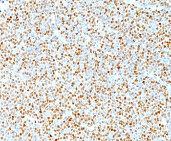 Cyclin D1 Antibody