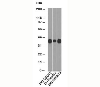 Cyclin D1 Antibody