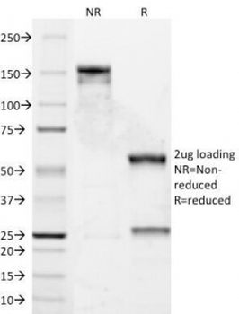 Cyclin D1 Antibody