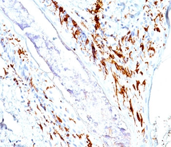 CD1a Antibody Cocktail