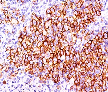 CD30 Antibody