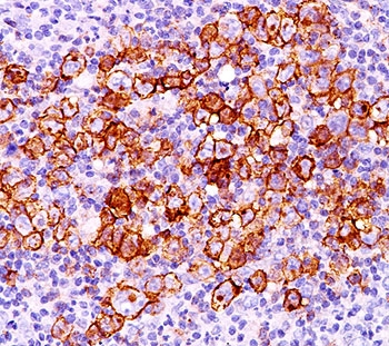 CD30 Antibody