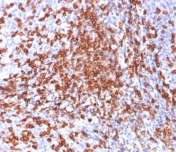HCAM Antibody / CD44