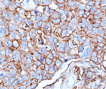 HCAM Antibody / CD44