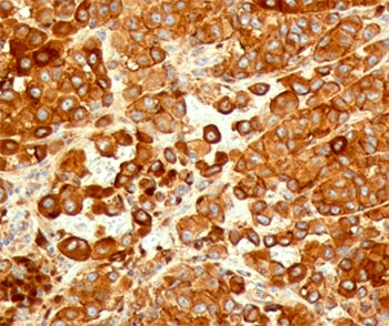 CD63 Antibody / LAMP-3