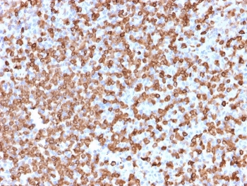CD74 / CLIP Antibody