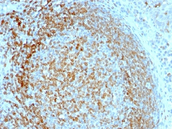 CD74 / CLIP Antibody