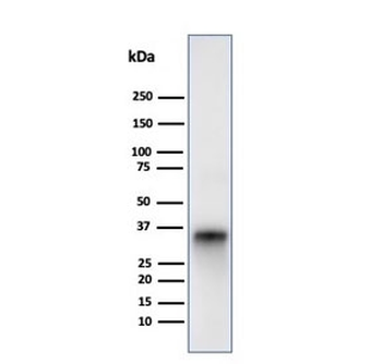 CD74 Antibody