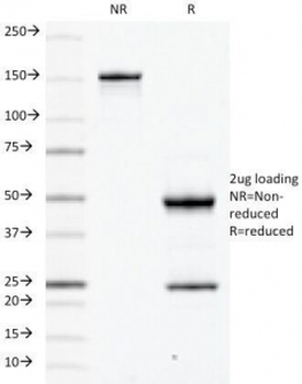 CD79a Antibody