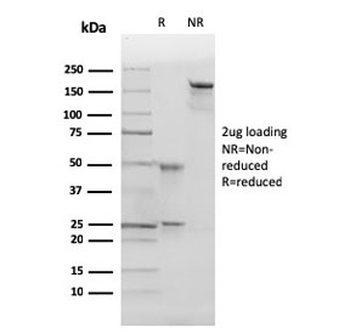 p27Kip1 Antibody