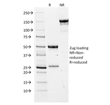 CEA Antibody / CEACAM5