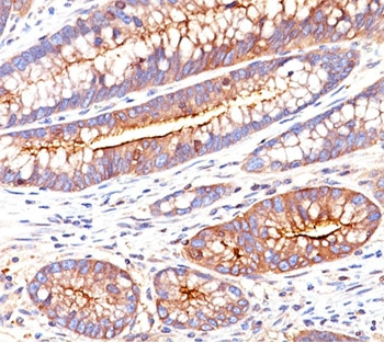 CEA Antibody / CEACAM5