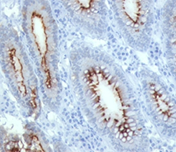CEA Antibody / CEACAM5