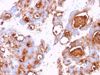 CEA Antibody / Carcinoembryonic Antigen