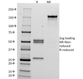 hCG alpha Antibody / Luteinizing Hormone alpha