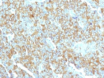 Chromogranin A Antibody