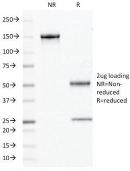Chromogranin A Antibody