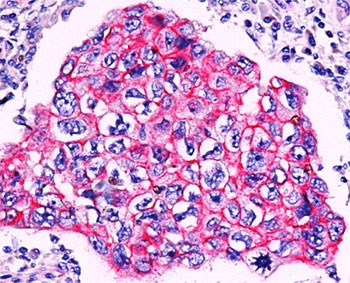 Beta-Catenin Antibody