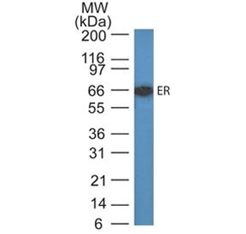 Estrogen Receptor Antibody (alpha)