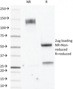 Estrogen Receptor beta Antibody