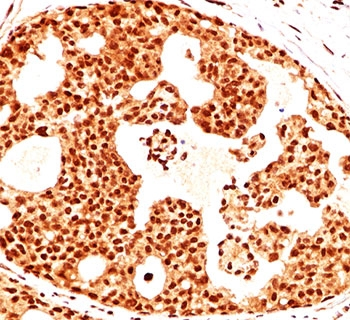 Estrogen Receptor beta Antibody