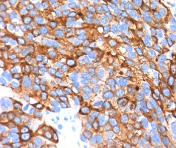 MART-1 Antibody Cocktail