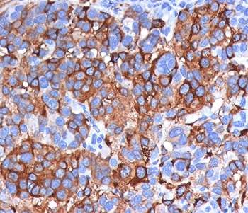Melan-A Antibody