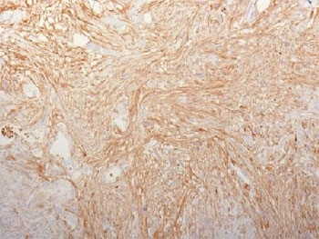 Fibronectin Antibody