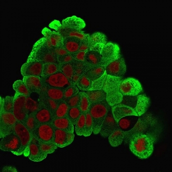 HSP27 Antibody / HSPB1