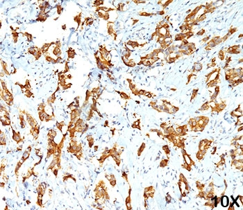HSP27 Antibody