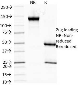 HSP27 Antibody