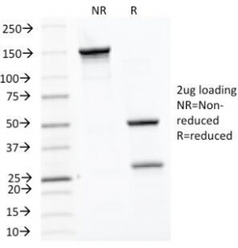 HSP60 Antibody