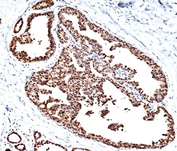 HSP60 Antibody / HSPD1