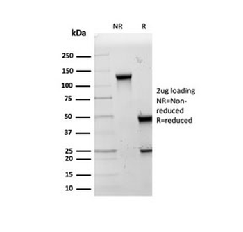 HSP60 Antibody