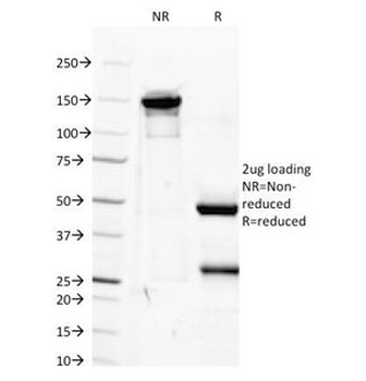 IGF1 Antibody